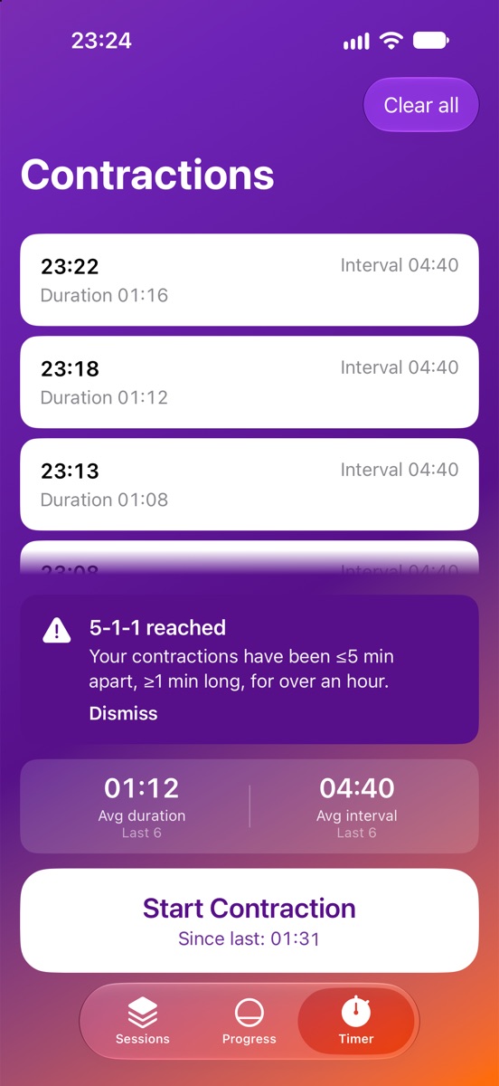 The 5-1-1 note: contractions five minutes apart or less, a minute long, for over an hour